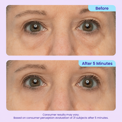 Instant Lift Eye Gel