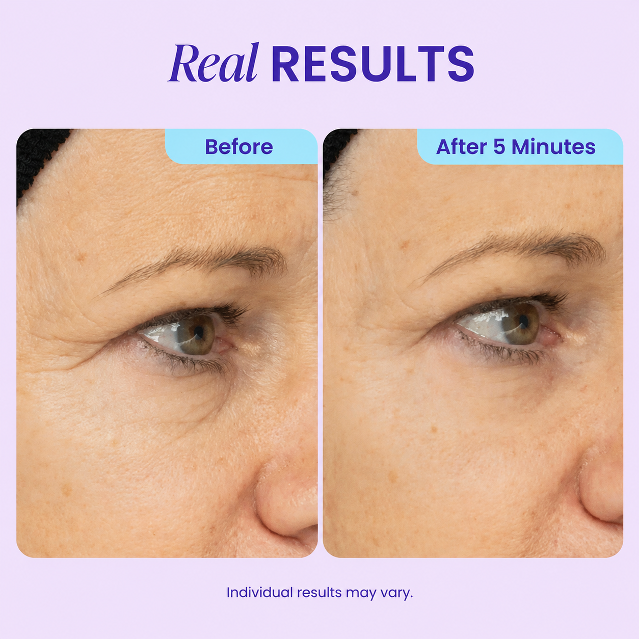 Instant Lift Eye Gel