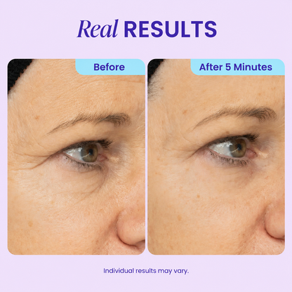 Instant Lift Eye Gel